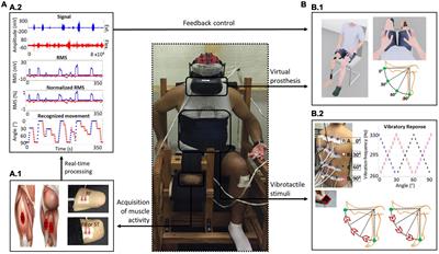 Embodiment of a virtual prosthesis through training using an EMG-based human-machine interface: Case series